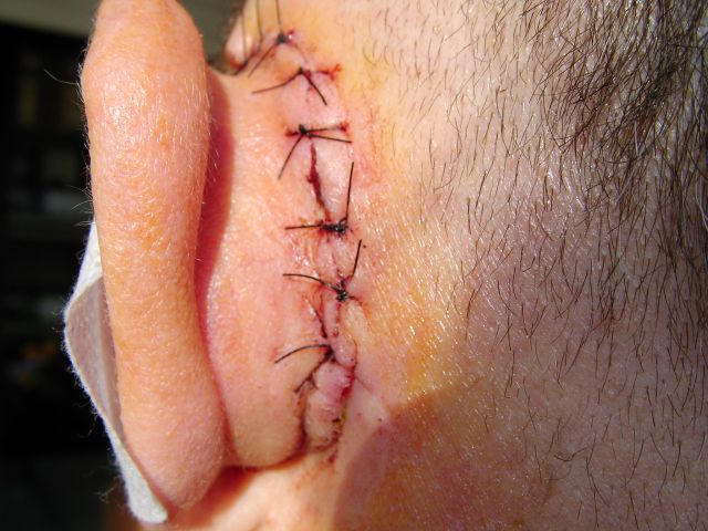 orecchione rid..jpg